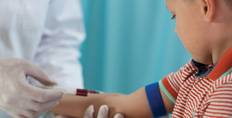 La hemofilia puede traer complicaciones severas desde la infancia, pero el tratamiento adecuado es clave para su control.