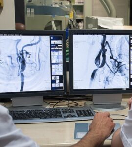 Un nuevo estudio demuestra que administrar un fármaco tras la trombectomía incrementa la recuperación de pacientes con ictus grave.