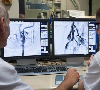 Un nuevo estudio demuestra que administrar un fármaco tras la trombectomía incrementa la recuperación de pacientes con ictus grave.