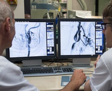 Un nuevo estudio demuestra que administrar un fármaco tras la trombectomía incrementa la recuperación de pacientes con ictus grave.