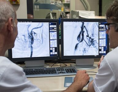 Un nuevo estudio demuestra que administrar un fármaco tras la trombectomía incrementa la recuperación de pacientes con ictus grave.