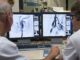 Un nuevo estudio demuestra que administrar un fármaco tras la trombectomía incrementa la recuperación de pacientes con ictus grave.