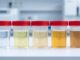 Descubre qué puede indicar el color de la orina sobre tu salud y cuándo consultar a un médico.